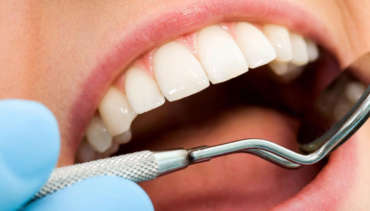 Endodoncija – liječenje zuba